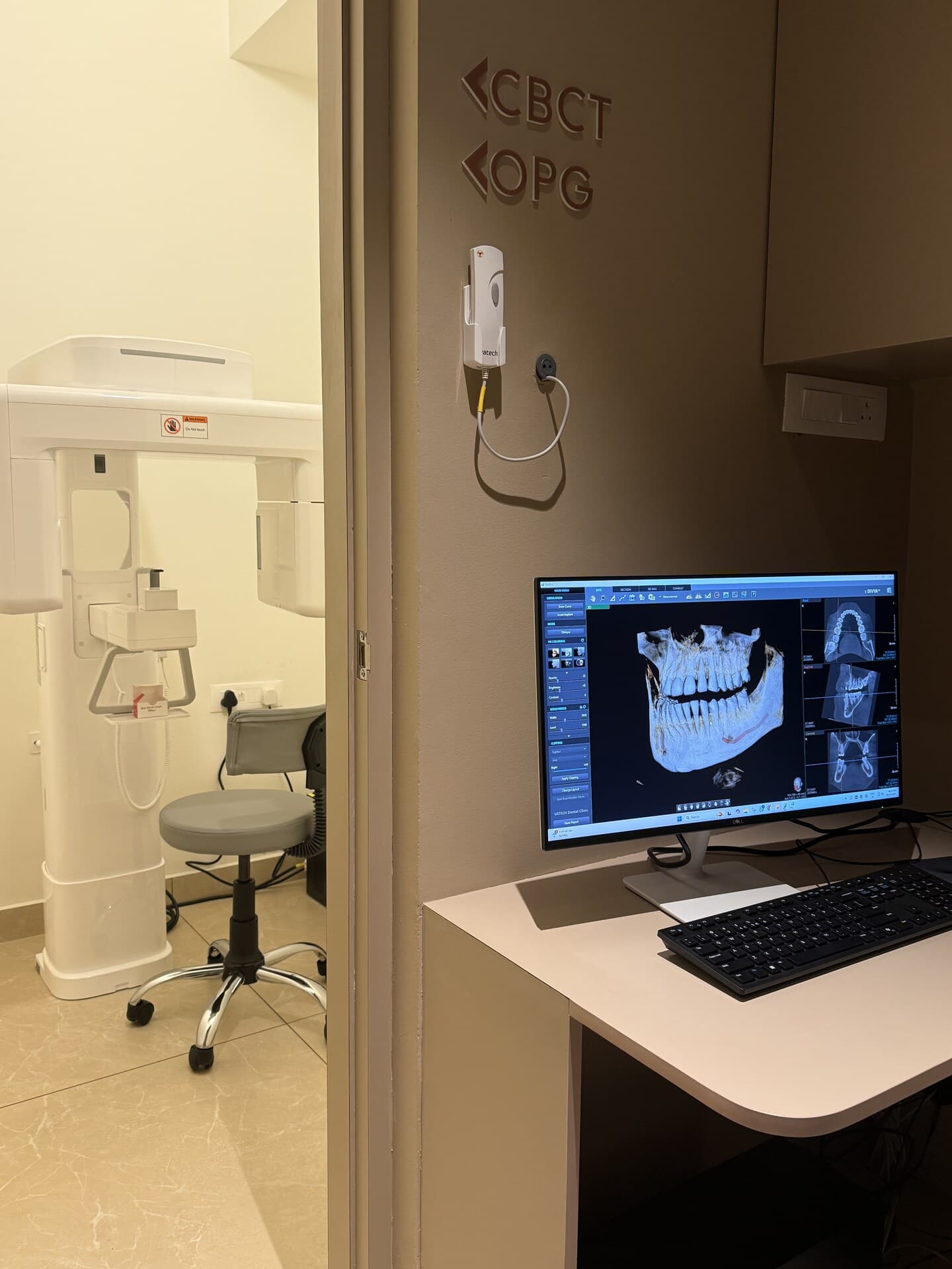 CBCT Imaging